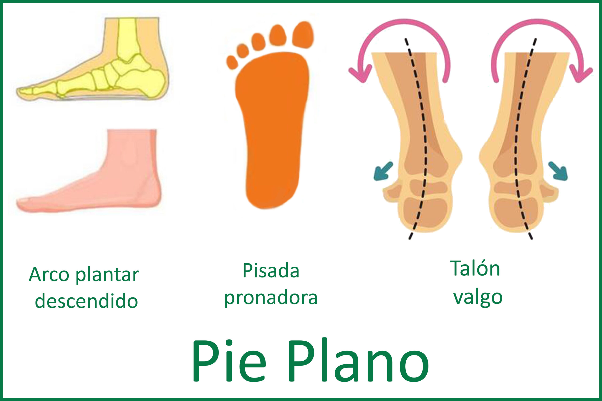 Pie plano